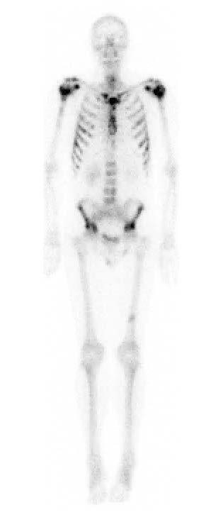 Patient case study 1: bone