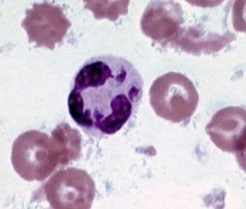 ESAMI MICROSCOPICI CITOLOGICI Amastigoti nel sangue periferico Descrizione della segnalazione Casuale rinvenimento di numerosi amastigoti (nei neutrofili [Figura 13] ed extracellulari [Figura 14]; L.