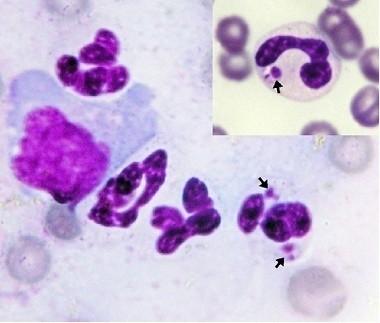 ESAMI MICROSCOPICI CITOLOGICI Amastigoti nel sangue periferico Descrizione della segnalazione Occasionali amastigoti intraneutrofilici (Figura 15) nello striscio di un Boxer maschio di 8 mesi (il