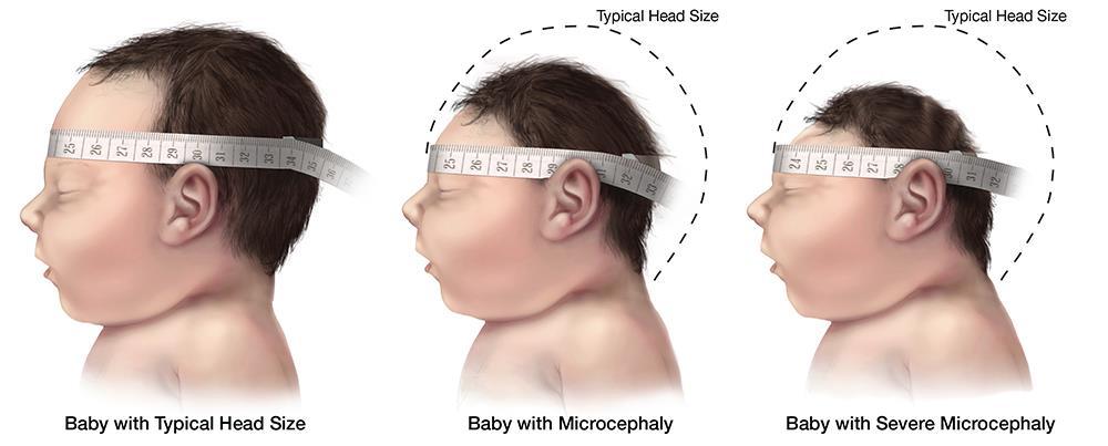 Si può inoltre utilizzare il WHO Child Growth Standards (WHO CGS) http://www.who.