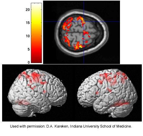 Imaging funzionale Oggi: Possibile acquisire > 1 immagine/sec Possibile realizzare video, p es dell attivita