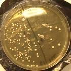eubatteri gram positivi alto contenuto GC basso contenuto GC Streptomyces Arthrobacter Micrococcus Mycobacterium Nocardia Propionibacterium Bifidobacterium Clostridium Lactobacillus Lactococcus