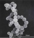 eubatteri gram positivi alto contenuto GC basso contenuto GC Streptomyces Arthrobacter Mycobacterium Propionibacterium Bifidobacterium Clostridium Lactobacillus Bacillus Staphylococcus Listeria