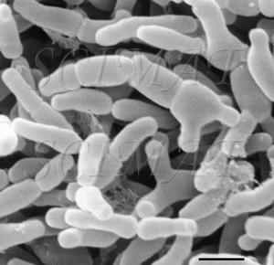 Bifidobacterium Sono note 32 specie e fermentano substrati diversi