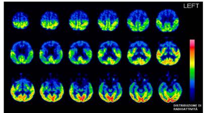 NEUROIMAGING