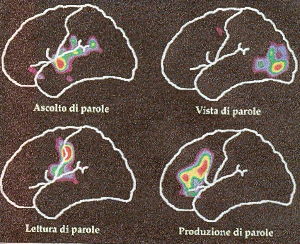 Attivazione delle parti dell emisfero sinistro nel normolettore in