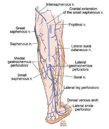 Duplex Ultrasound Investigation of the Veins in Chronic Venous Disease of the Lower Limbs UIP Consensus Primary uncomplicated small saphenous territory varicose veins Duplex scanning is considered to