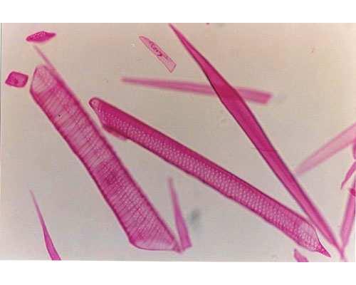 TESSUTI CONDUTTORI Xilema: E il principale tessuto conduttore di acqua e Sali minerali delle piante ed è fortemente implicato nel sostegno stesso della pianta.