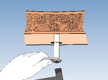 FRATTURE DIAFISARIE TIBIA Eseguire sempre la riduzione anche approssimativa della frattura. È necessario ridurre qualsiasi vizio di rotazione prima di montare il fissatore.