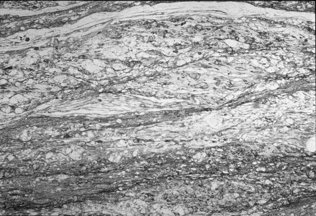 Note Illustrative della Tavola 25 III - Rabbi Fig. 26 Foto al microscopio di micascisti epidotico milonitici a letto della linea di Peio (Larghezza della foto 5 mm circa).