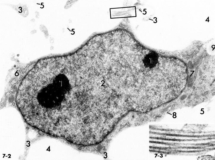 Cellula mesenchimale (staminale pluripotente) fibrille prolungam. RER nu eucrom. Go. prolungam. fibrille Dalla staminale plurip.