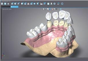 può aggiungere una struttura secondaria di elementi estetici sopra al setup virtuale,