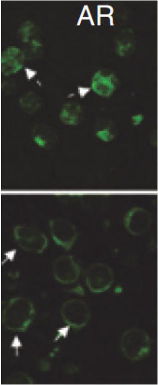 intracellulare del recettore androgenico Microtubule
