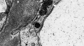 cellule endoteliali (Lupus) Fusione dei