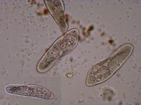 Intorno al 700: ripresa della teoria della generazione spontanea L olandese Van Leeuwenhoek, inventore del microscopio, aveva osservato altre forme di vita invisibili a occhio nudo: i batteri.