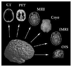 Modalità diagnostiche Due principali categorie: Anatomiche, catturano principalmente la morfologia degli