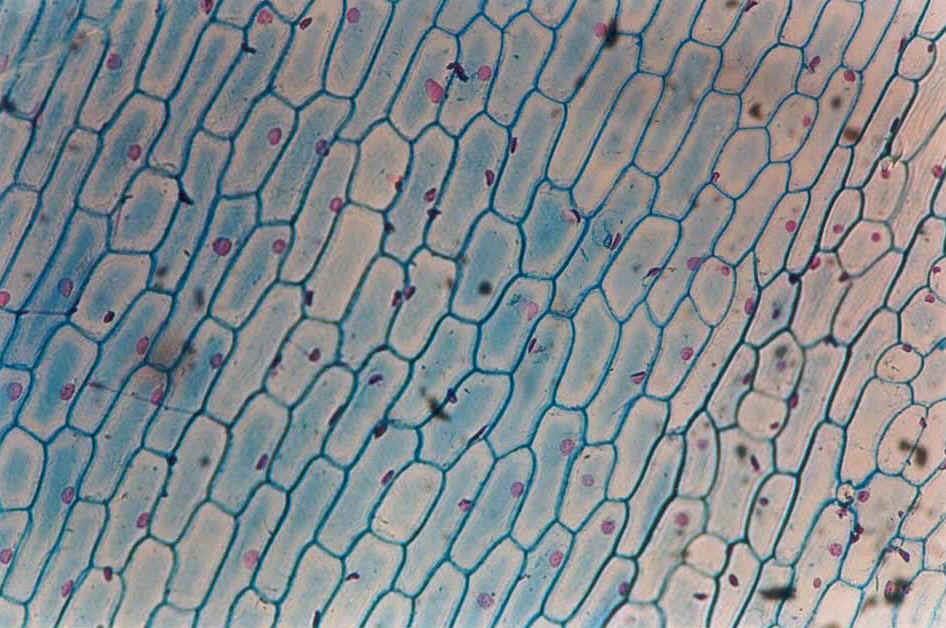 Le cellule vegetali Catafillo di cipolla,