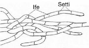 Tipologie di tallo nei funghi Organizzazione sifonale (filamenti plurinucleati): IFE senza setti (IFE