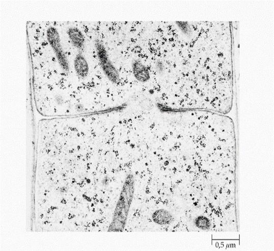 Nella maggior parte dei funghi con ife settate i setti sono attraversate da un poro centrale, tale da consentire comunicazione tra i protoplasti di