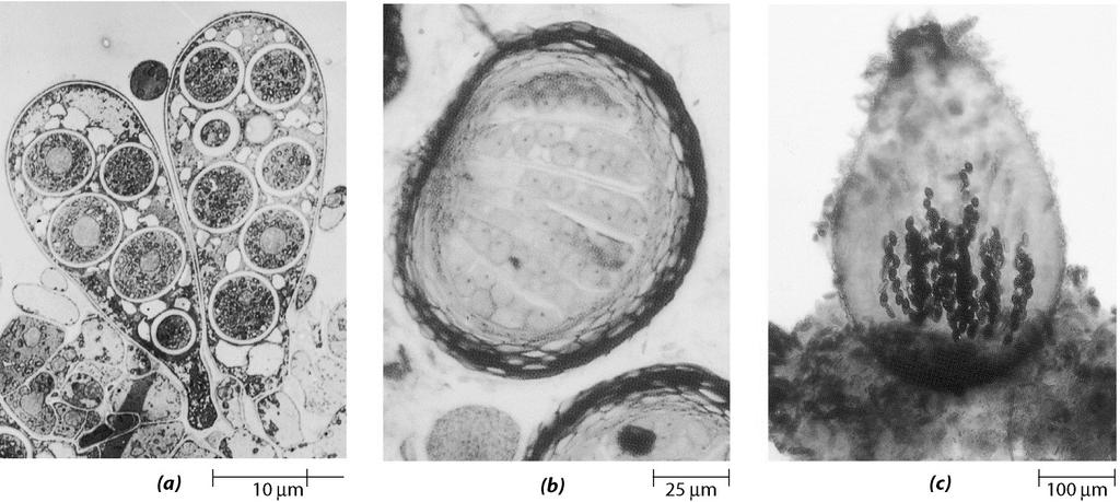 zigospore, ascospore,