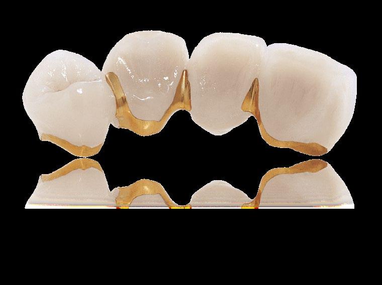 Linea ceramica Duceragold Kiss Duceragold Kiss è il materiale di rivestimento ceramico per leghe ad alta espansione con CET compreso tra 16,2 e 17,6 µm/m K (25-600 C).