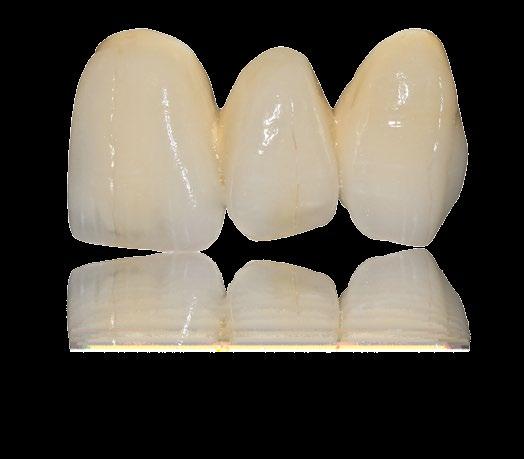 Cercon ceram Kiss è indicata indifferentemente per l uso su strutture realizzate in Cercon base e Cercon ht.