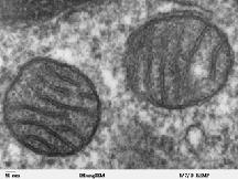 Osservati al microscopio elettronico i mitocondri appaiono dotati di una doppia membrana: la più esterna è distesa e delimita il mitocondrio, quella interna è ripiegata su se stessa a formare pieghe