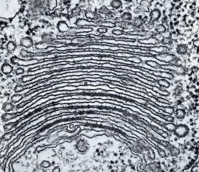 COMPLESSO DI GOLGI È FORMATO DA UNA SERIE DI CISTERNE MEMBRANOSE APPIATTITE, CON I MARGINI DILATATI, IMPILATE LE UNE SOPRA LE