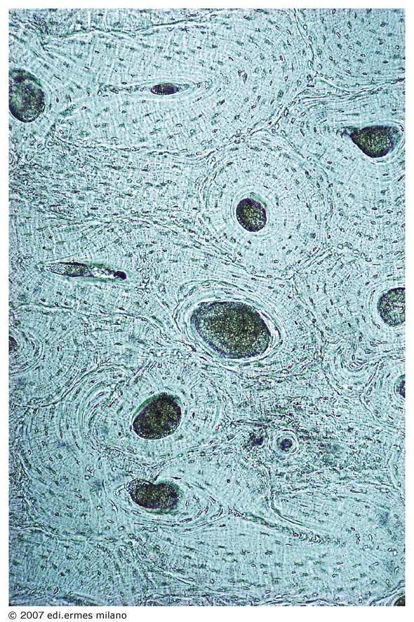 Tessuto osseo lamelle lacune L osso compatto non decalcificato appare