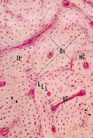 certo spessore all interno delle quali sono presenti lacune con gli