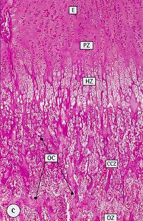 Cartilagine di accrescimento o disco epifisario zona di riserva o