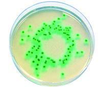 Cronobacter (Enterobacter sakazakii) spp.