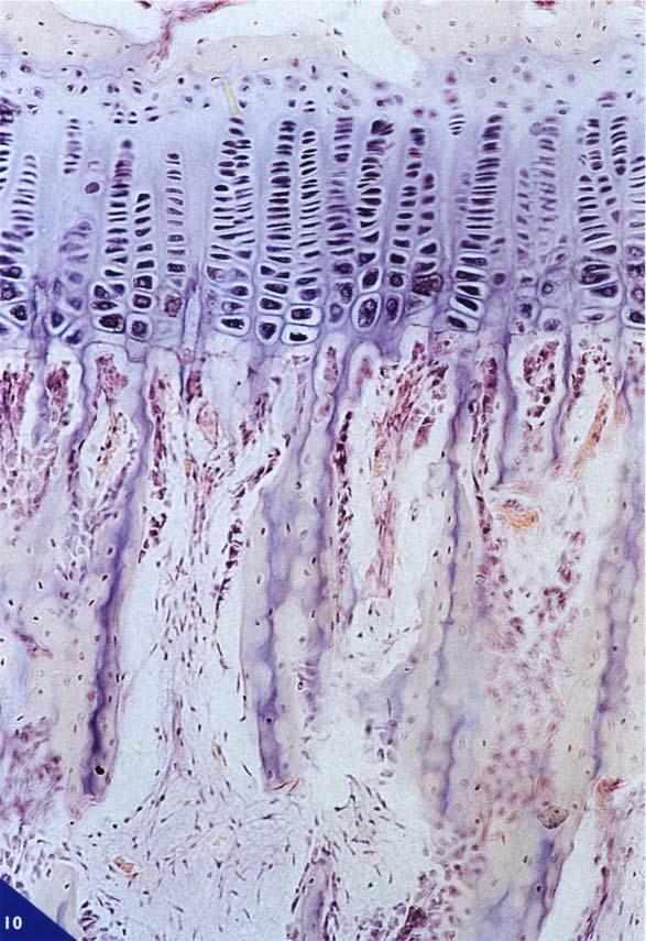 ACCRESCIMENTO IN LUNGHEZZA DELLE OSSA A seguito della comparsa del centro primario di ossificazione nella diafisi, i condrociti delle metafisi, invece di essere raccolti in modo casuale a piccoli