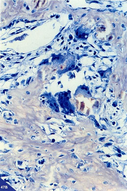 La membrana si specializza presentando numerose estroflessioni verso la superficie ossea, mentre la parte rivolta verso gli spazi extracellulari, stroma di sostegno e vasi, si presenta convessa e