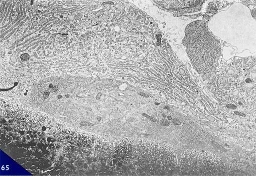 Golgi iuxtanucleare e un nucleo ricco di eucromatina.