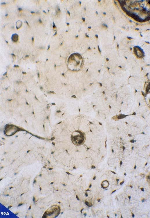 OSS0 SECONDARIO O DI SOSTITUZIONE L osso secondario compare nell uomo intorno al settimo mese di vita intrauterina e la sua formazione continua per tutto l arco della vita, inizialmente per