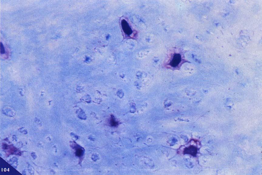 L irregolarità distributiva della matrice e delle cellule ossee dipende dal fatto la formazione di nuovo osso si è realizzata in tempi estremamente rapidi.