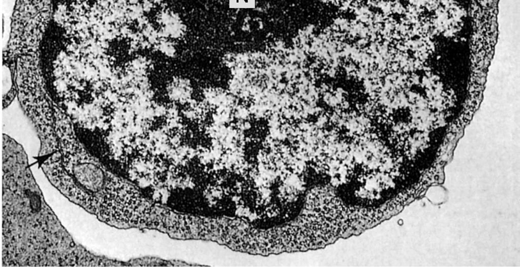 T derivano dal timo - T CITOTOSSICI uccidono cellule - T HELPER Attivano i T