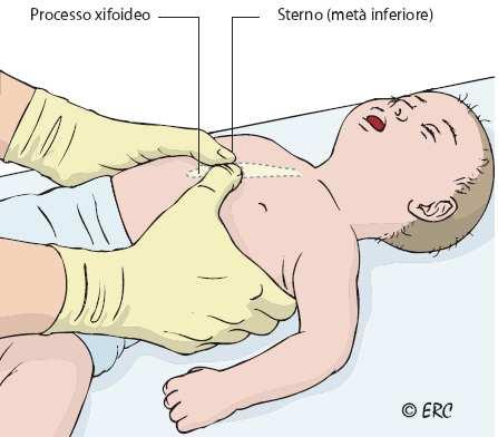 Sequenza BLS pediatrica C COMPRESSIONI TORACICHE