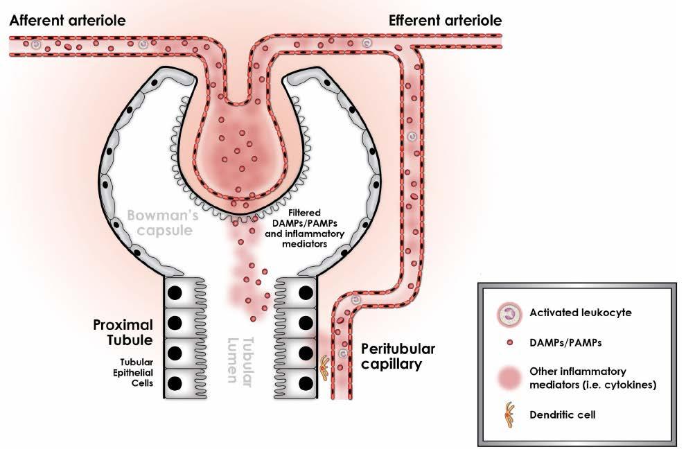 Septic Acute Kidney Injury Gomez H, et