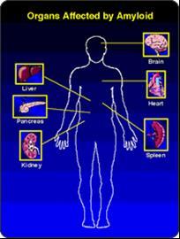 Molte malattie sono dovute al ripiegamento difettoso «misfolding» di proteine Alcune patologie hanno in comune un non corretto avvolgimento di proteine.