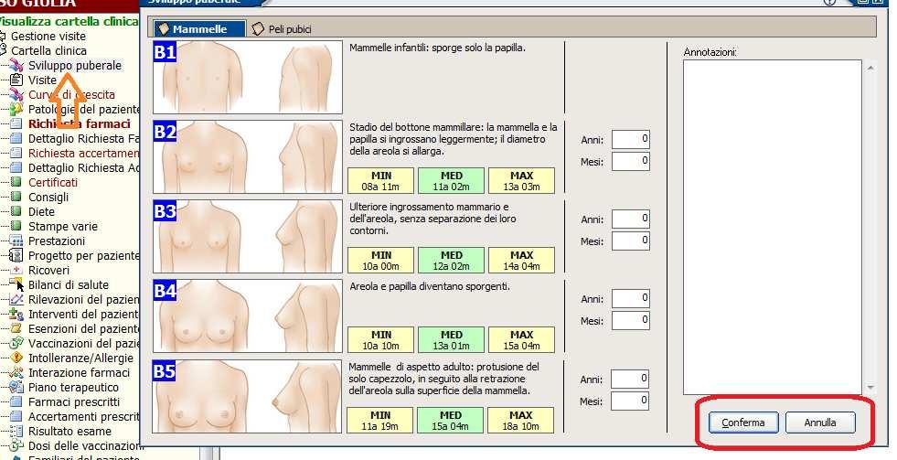 SVILUPPO PUBERALE E stato prevista la gestione dello sviluppo puberale dei pazienti con i vari stadi.