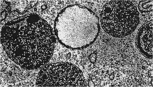Lisosomi Organuli citoplasmatici di forma più o meno tondeggiante delimitati da una sola unità di membrana misurano circa 0.
