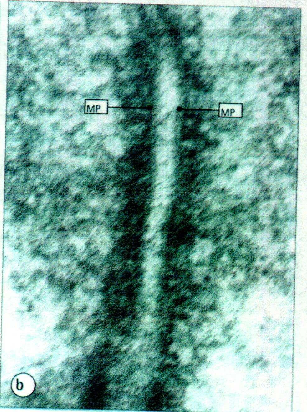 Giunzione occludente Al microscopio elettronico, una giunzione occludente appare come un area di stretta apposizione di aree