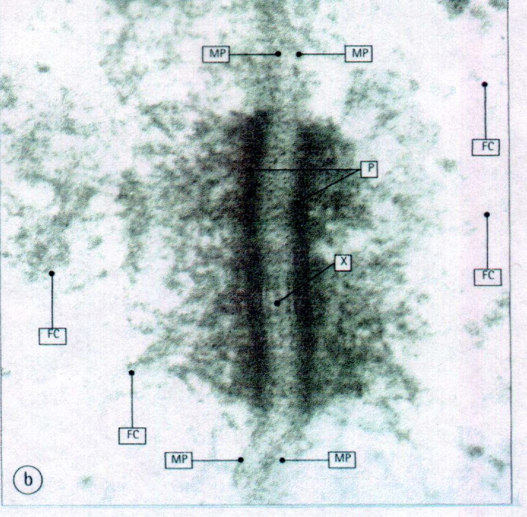 Desmosoma Le placche di adesione discoidali (P) nelle cellule adiacenti si evidenziano come aree elettrondense entro le quali si inseriscono i filamenti di citocheratina (FC).