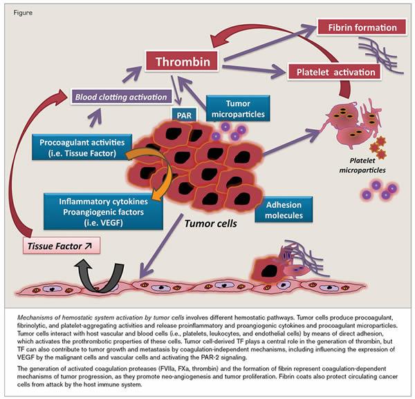 Trombosi e cancro The Open Cardiovascular Medicine