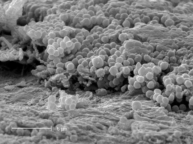 Particolare del biofilm