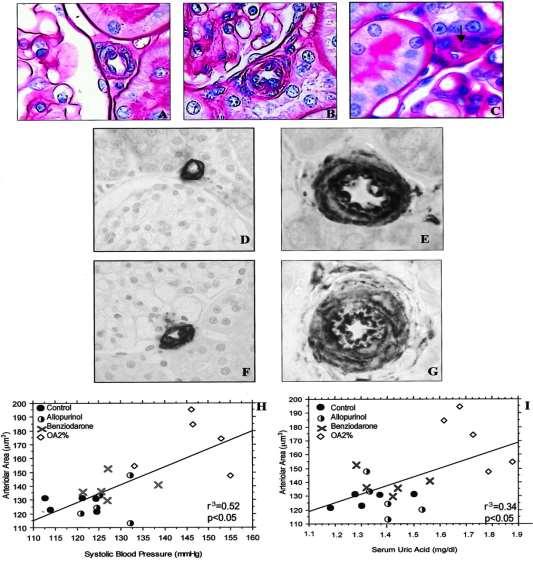 Mazzali M.et al. Hyperuricemia induces a primary renal arteriolopathy in rats by a blood pressure-independent mechanism. Am J Physiol Renal Physiol 2002.