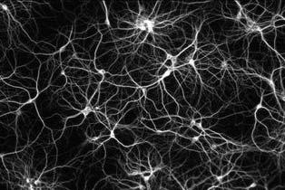 Capitolo 2 Reti Neurali Artificiali Per svolgere i compiti cui sono adibite, le reti neurali biologiche utilizzano un numero imponente, circa 10000000, di semplici elementi computazionali, chiamati