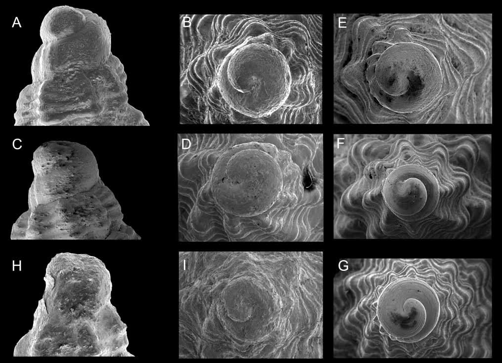 Fig. 9. Protoconche. A, B. Fusinus clarae n.sp.; C, D. Fusinus ventimigliae n.sp.; E. Fusinus alternatus; F. Fusinus pulchellus; G. Fusinus rostratus, fenotipo tirrenico; H, I. Fusinus patriciae n.sp. Fig.